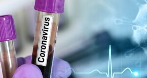 COVID-19: Nigeria records 33 deaths, 125 infections