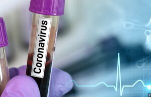 COVID-19: Nigeria records 33 deaths, 125 infections