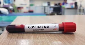 COVID-19: Nigeria records 573 new infections, 6 deaths COVID-19 test kits, COVID-19 cases, NCDC
