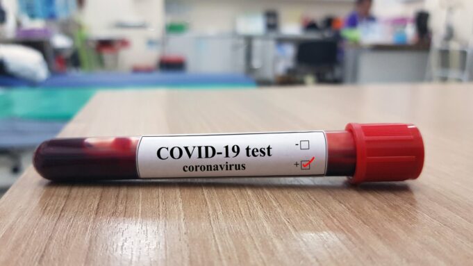 COVID-19 test kits, COVID-19 cases, NCDC