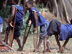 Jigawa: Between Gov Namadi and Persons with Disabilities Polio