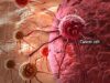 Infections linked to 2.3m cancer cases globally — Study