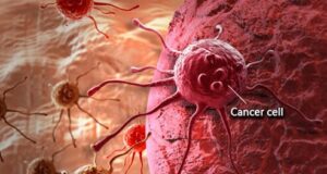 NHIS, Swiss drug giant sign MoU on cancer care reimbursement initiative