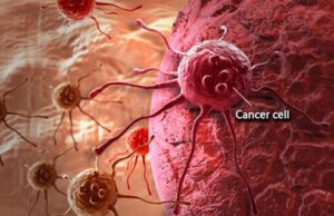 NHIS, Swiss drug giant sign MoU on cancer care reimbursement initiative