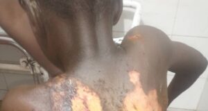 Woman undergoes psychiatric test for ‘bathing’ son with boiled water