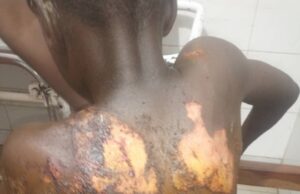 Woman undergoes psychiatric test for ‘bathing’ son with boiled water