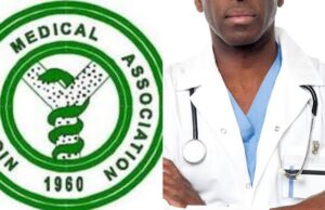 Kano NMA chair urges FG to address ‘worsening’ brain drain Ogun, NMA, Medical doctors