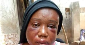 Journalist severely beaten by sacked PHCN official husband in Adamawa Journalist