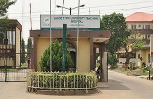 Japa: 150 nurses resigned from LASUTH – CMD Conjoined twins, LASUTH