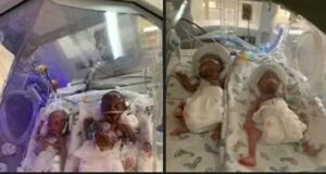 Lecturer delivered of septuplets in Anambra, needs N19m Lecturer