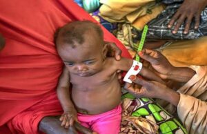 Doctors Without Borders treats 5,076 malnourished children free in Kano