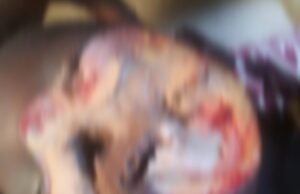 Strange ailment hits Adamawa community