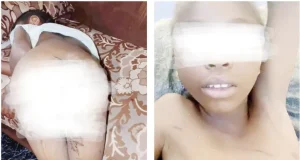 Woman arrested for burning stepdaughter’s private parts with hot spoon