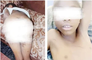 Woman arrested for burning stepdaughter’s private parts with hot spoon
