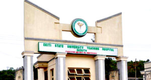 Ekiti govt sacks EKSUTH surgeon over alleged kidney removal