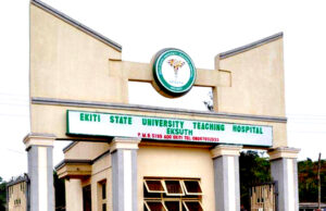 Ekiti govt sacks EKSUTH surgeon over alleged kidney removal
