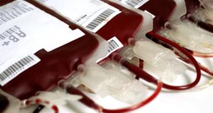 Jehovah’s witnesses update doctrine on blood use in care