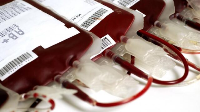 Jehovah’s witnesses update doctrine on blood use in care