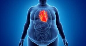 Nigeria ranks lowest in global obesity response index