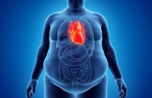 Nigeria ranks lowest in global obesity response index