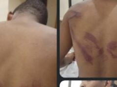 ‘I refused cultism, they beat me’ — student alleges assault by soldiers