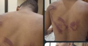 ‘I refused cultism, they beat me’ — student alleges assault by soldiers