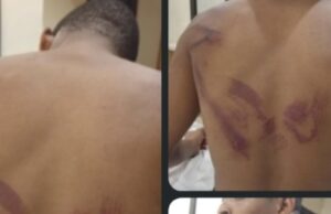 ‘I refused cultism, they beat me’ — student alleges assault by soldiers