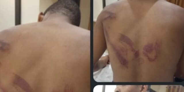 ‘I refused cultism, they beat me’ — student alleges assault by soldiers