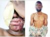 I was paid N500,00 to burn spa worker with acid — Suspect