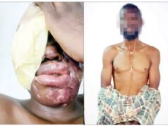 I was paid N500,00 to burn spa worker with acid — Suspect