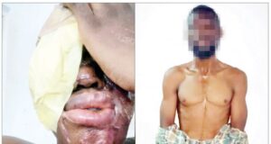 I was paid N500,000 to burn spa worker with acid — Suspect
