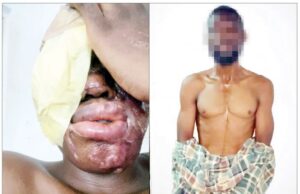 I was paid N500,000 to burn spa worker with acid — Suspect