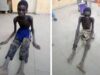 Photos of emaciated kidnap victims spark outrage over insecurity