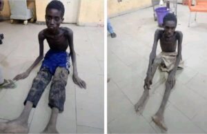 Photos of emaciated kidnap victims spark outrage over insecurity
