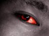 Apollo eye infection: Causes, symptoms, how to prevent it