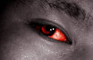Apollo eye infection: Causes, symptoms, how to prevent it