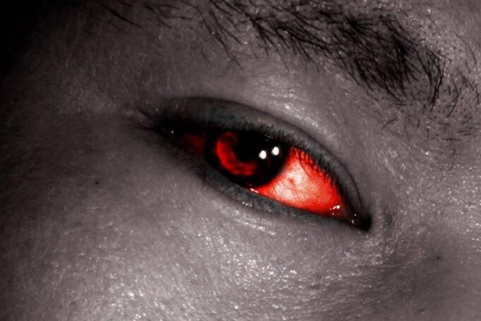 Red-Eye