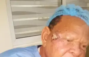 ANTP dispels cancer rumours as Elesho undergoes surgery