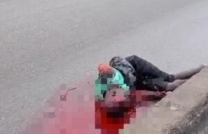 Motorist flees as pedestrian suffers severe injuries in Lagos
