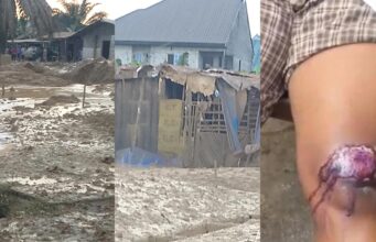 Pipeline explosion injures 20, razes 50 houses in Rivers