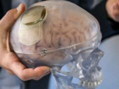 China approves brain implant to restore hand movement in paralysis patients
